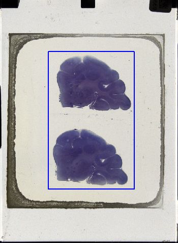 Media type: image; Special Collections 3043   shows specimen_part histological serial section;